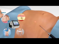 تجهیزات لیزر لیپو 30W 60W 980nm دیود لیپو لیزر ماشین برای کاهش وزن